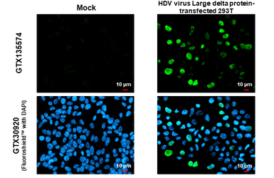 Anti-Hepatitis D virus Large delta protein antibody used in Immunocytochemistry/ Immunofluorescence (ICC/IF). GTX135574